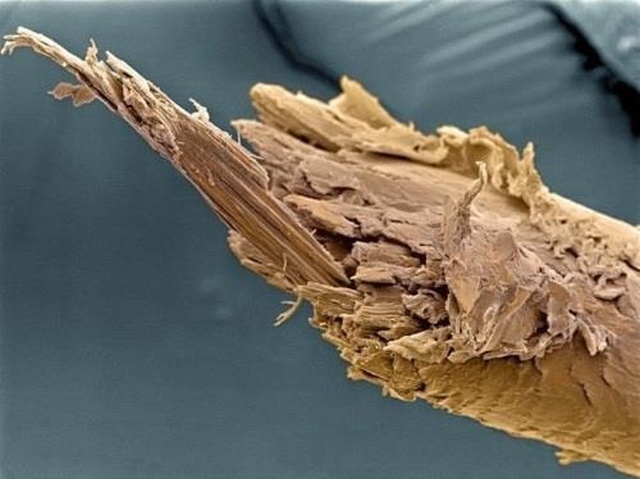 Органы и различные процессы человеческого тела под микроскопом (16 фото)