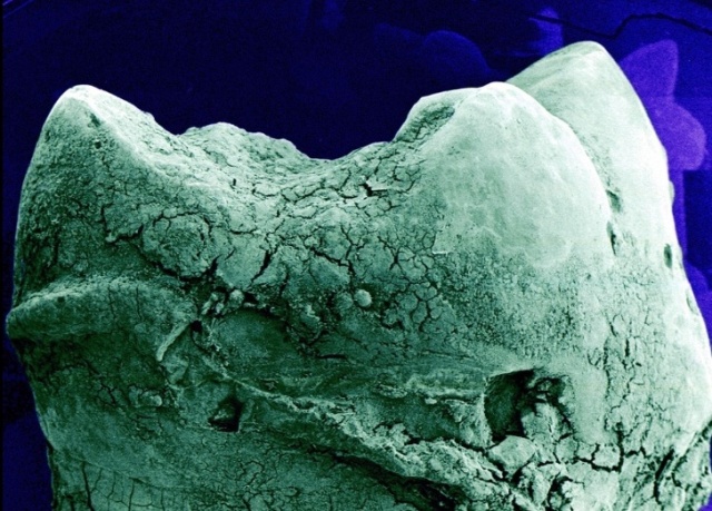 Органы и различные процессы человеческого тела под микроскопом (16 фото)