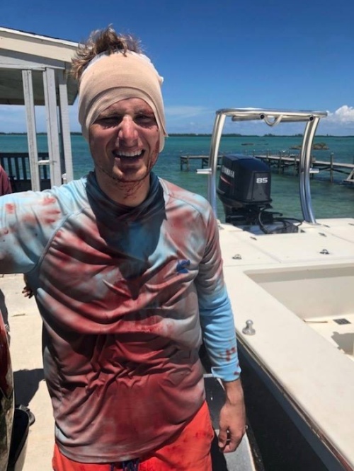 На Багамах дайвер заснял на видео, как на него напала акула (3 фото + видео)
