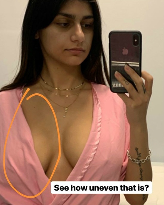 Порноактриса Миа Халифа "починила" свою поврежденную грудь (6 фото)