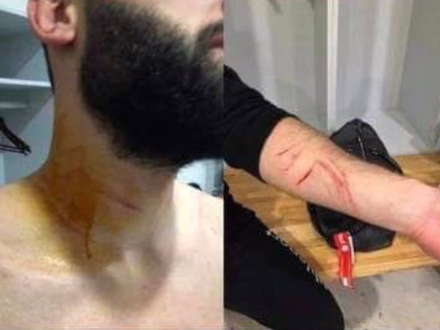Турецкий футболист Мансур Чалар пронес лезвие на матч и незаметно наносил удары соперникам (3 фото + видео)
