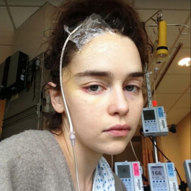 Фотографии Эмилии Кларк в больничной палате после инсульта (4 фото)