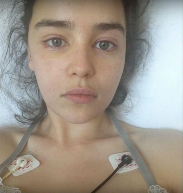Фотографии Эмилии Кларк в больничной палате после инсульта (4 фото)
