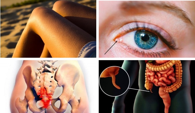 Следы на человеческом теле, оставленные эволюцией (10 картинок)