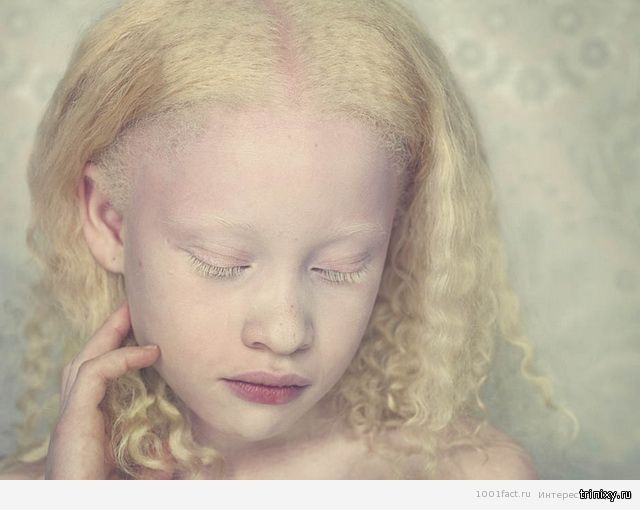 О людях — альбиносах