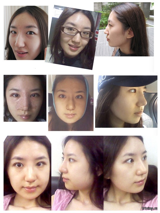 Корейская пластическая хирургия с фото «до» и «после»