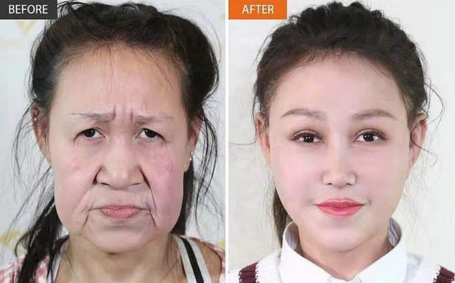 15-летнюю китаянку путали с бабушкой, но после операции она стала красавицей