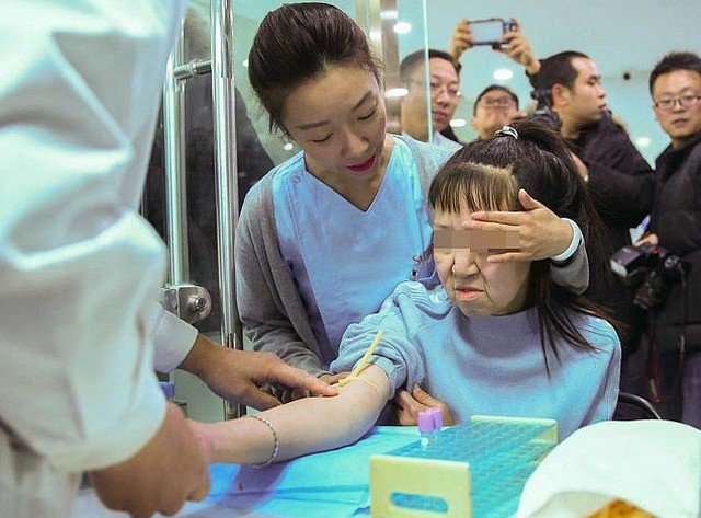 15-летнюю китаянку путали с бабушкой, но после операции она стала красавицей