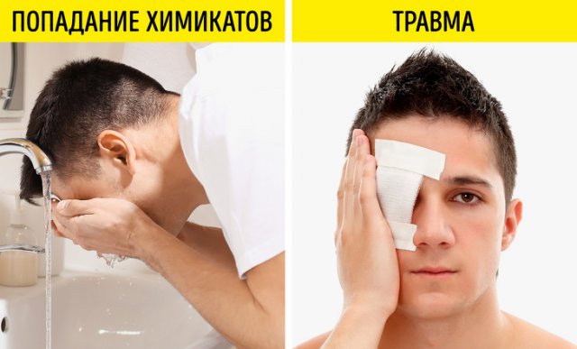 Травмы глаза
