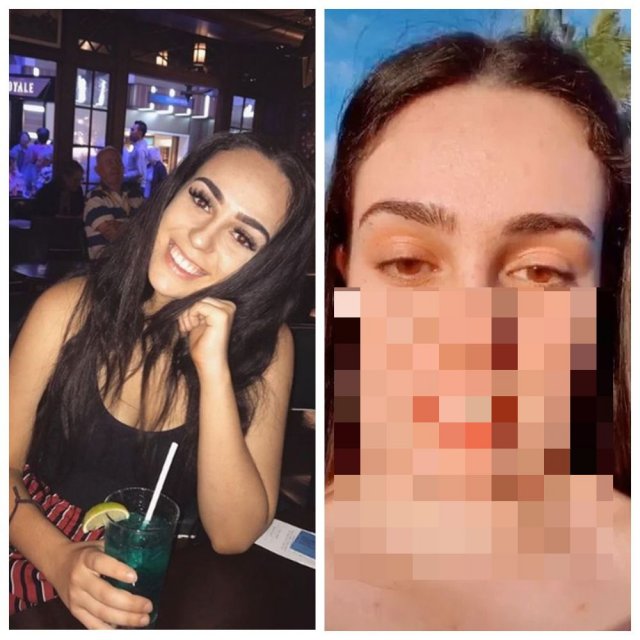 София Маррокуин решила избавиться от «пухлых» щек, но получила квадратное лицо и сняла реакцию родст