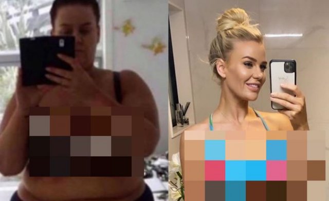 Симона Андерсон: девушка из Новой Зеландии скинула за 2 года 100 килограмм