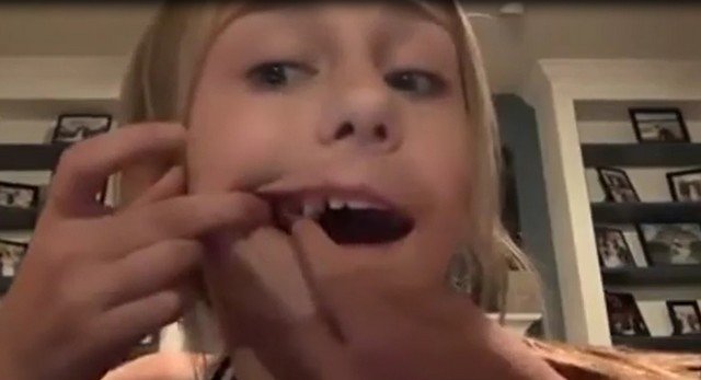 Девочка вырывает зуб