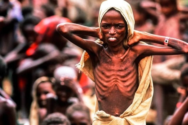 Голод в Сомали, 1992 год.
