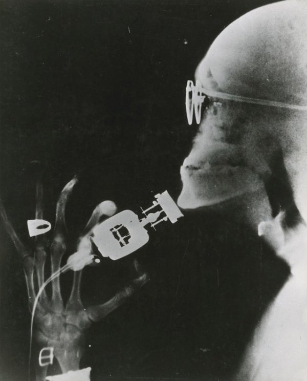 Рентгеновский снимок новой электробритвы Westinghouse во время использования (1941 г.)