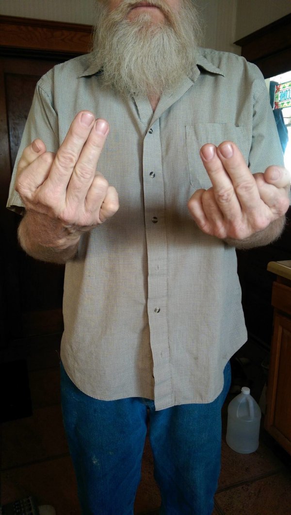 У моего папы по 6 пальцев на каждой руке