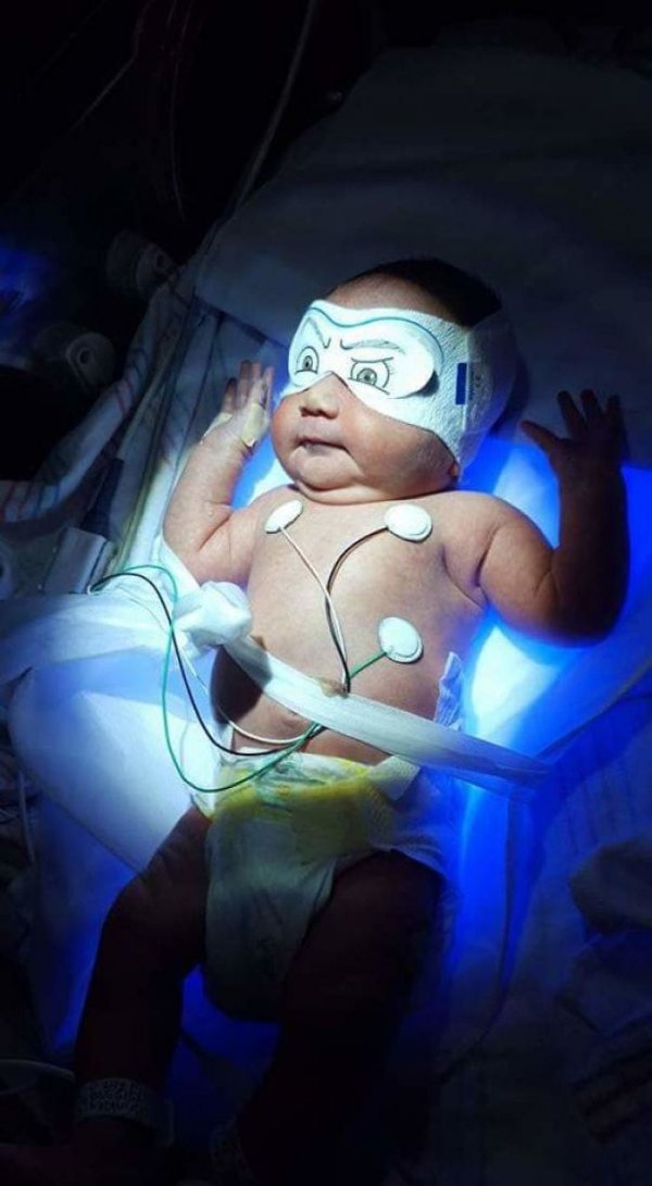 Моему новорождённому сыну нужно было регулярно лежать под фотолампой