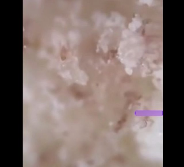 Мука под микроскопом