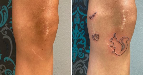 Люди, которые решили не прятать свои шрамы, а обыграть их с помощью татуировок