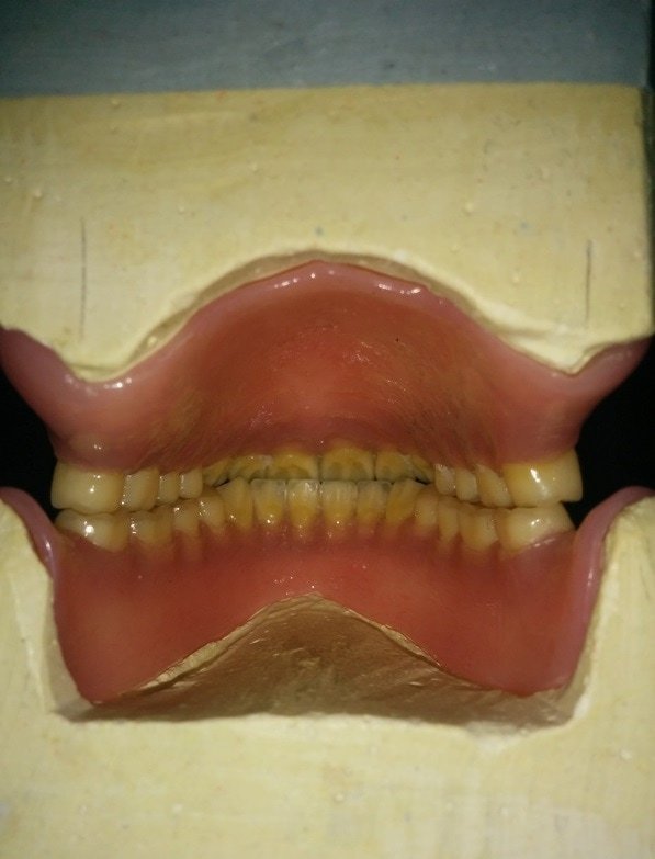 Зубной ряд изнутри