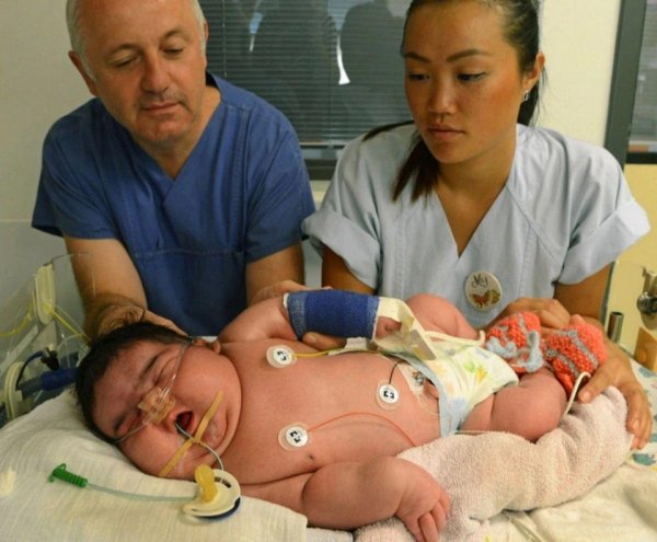 Новорождённый младенец размером с двухгодовалого ребёнка