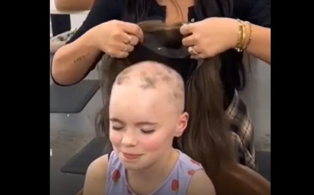 Девочка, страдающая алопецией получила в подарок парик