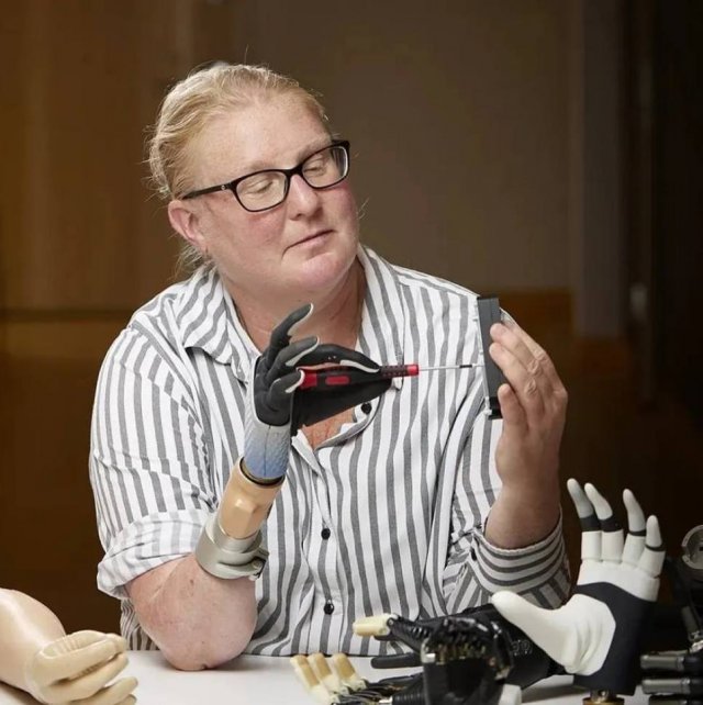 С помощью бионического протеза женщина впервые почувствовала силу нажима и текстуру поверхности