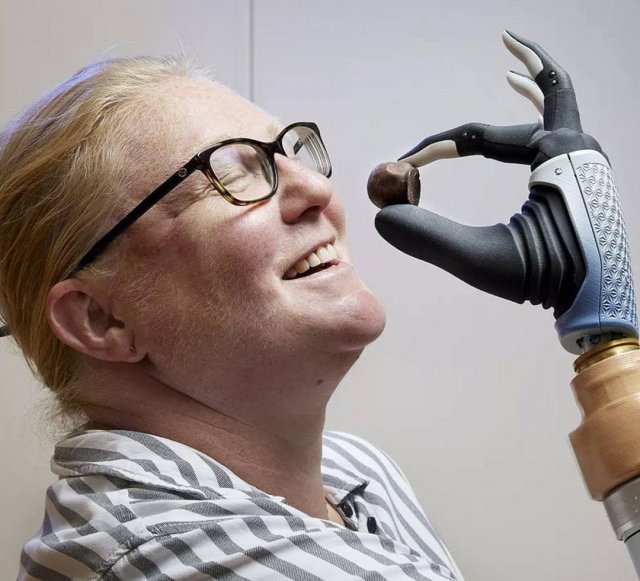 С помощью бионического протеза женщина впервые почувствовала силу нажима и текстуру поверхности
