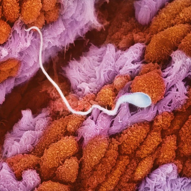 Сперматозоид движется по фаллопиевой трубе к яйцеклетке