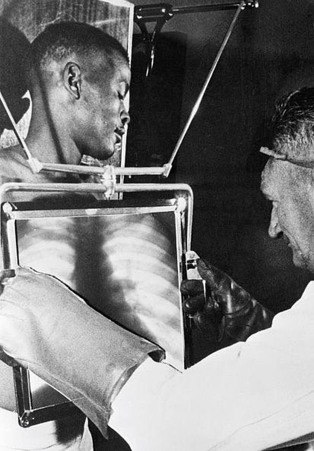 Рабочий алмазных шахт в конце каждой смены проходит проверку рентгеном перед тем как покинуть шахты. ЮАР, 1954 год.