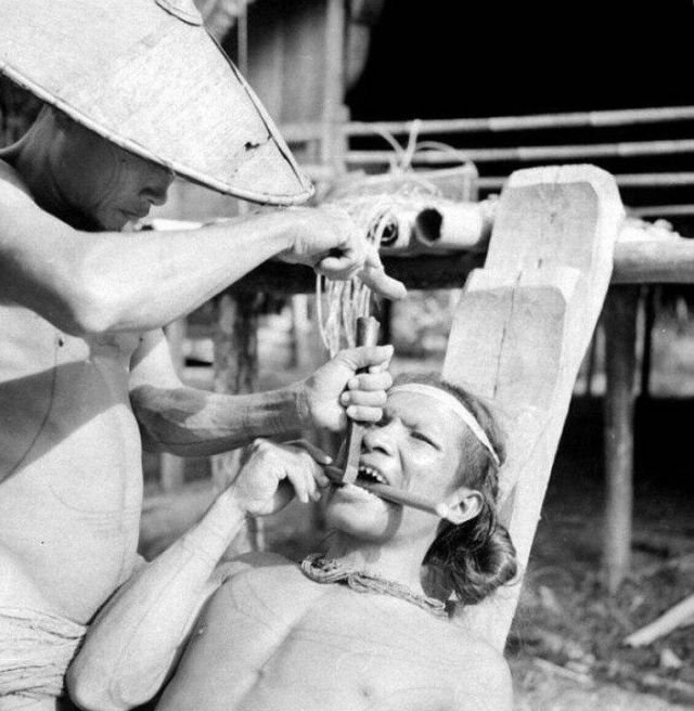 Заточка зубов у индонезийских племен, 1938 год.