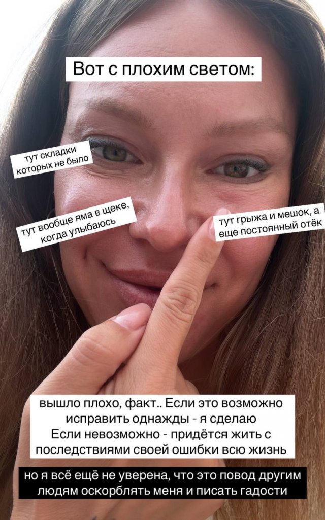 Певица Рита Дакота изуродовала себя после пластической операции Певица Рита Дакота изуродовала себя после пластической операции
