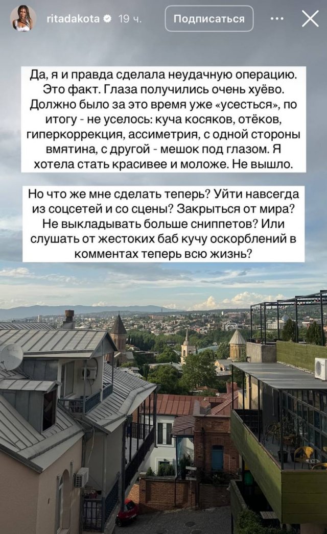 Певица Рита Дакота изуродовала себя после пластической операции Певица Рита Дакота изуродовала себя после пластической операции