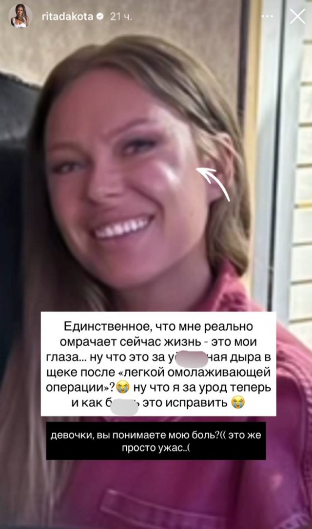 Рита Дакота и страшные последствия пластической операции