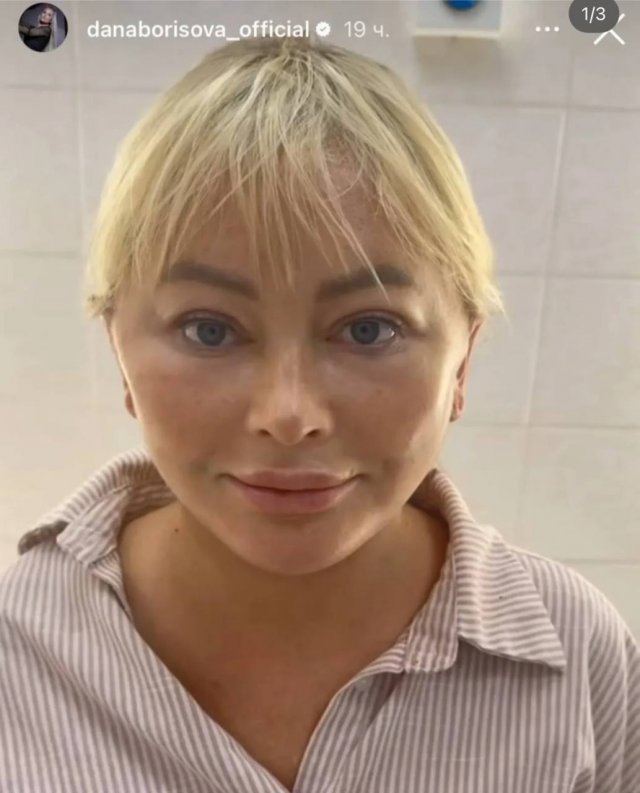 Дана Борисова сделала очередную пластику - и эти фото введут вас в ступор