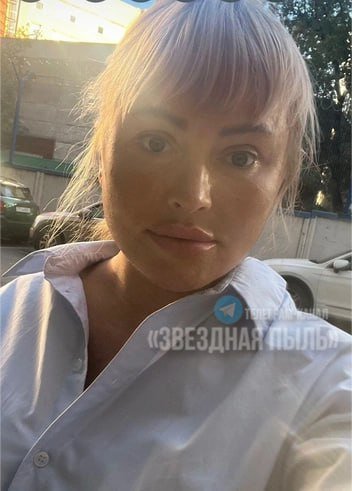 Новое лицо Даны Борисовой вызвало насмешки
