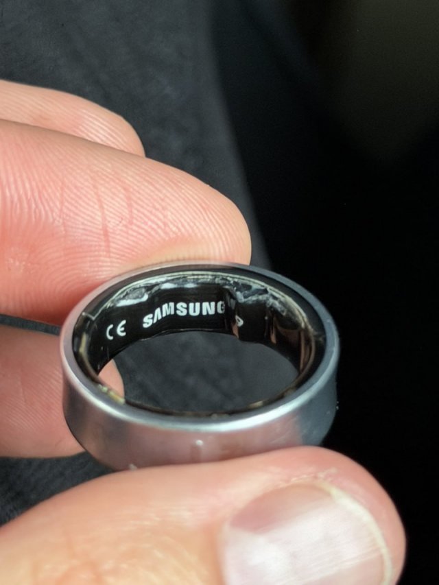 Мужчина чуть не потерял палец из-за умного кольца от Samsung