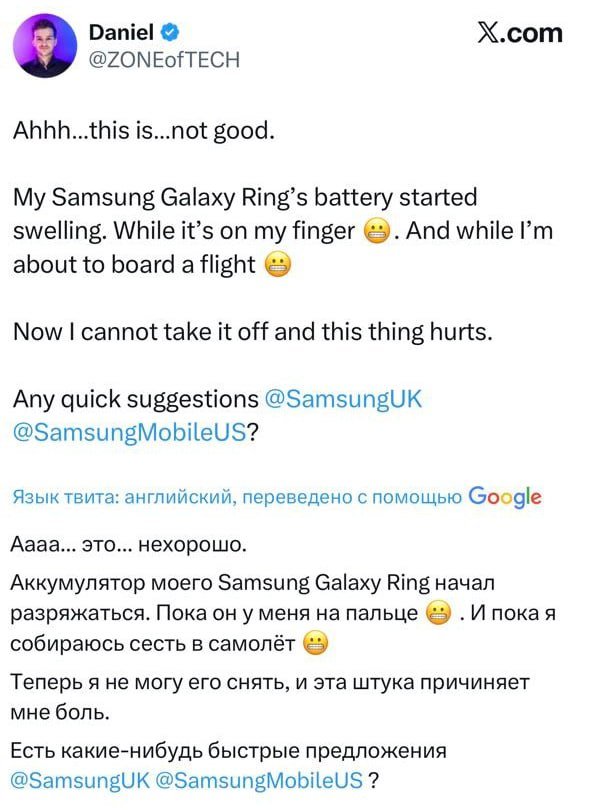Мужчина чуть не потерял палец из-за умного кольца от Samsung