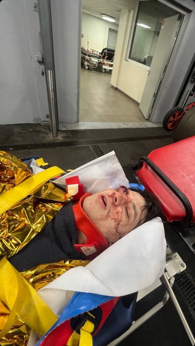 Участник &quot;голой вечеринки&quot; Васио выпал с третьего этажа в Париже - жутки кадры рэпера