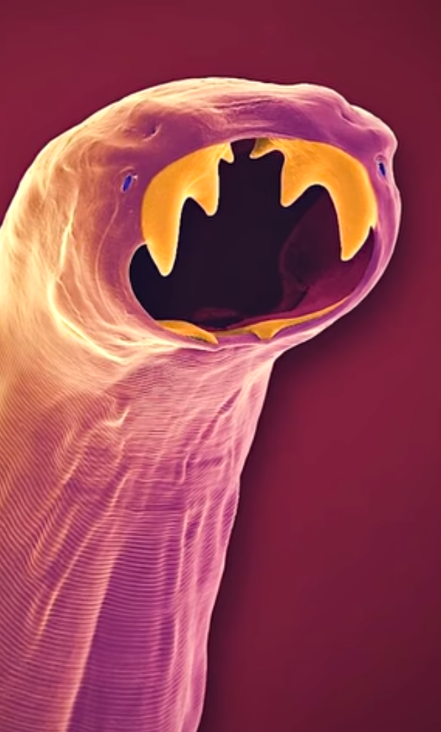 Мир глазами амебы