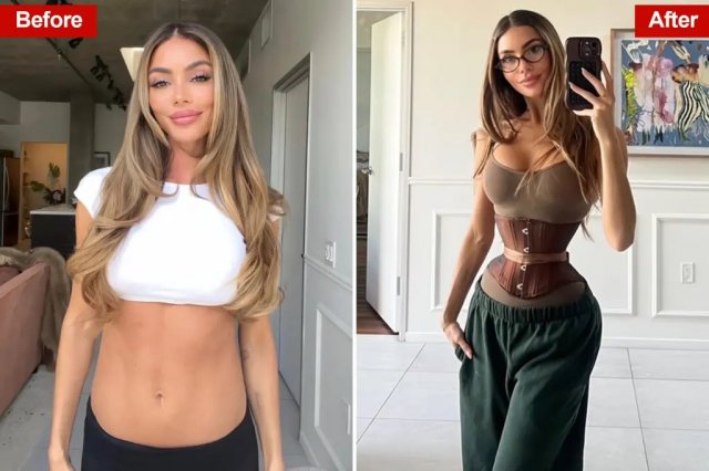 Девушки по всему миру начали массово удалять себе рёбра ради талии мечты