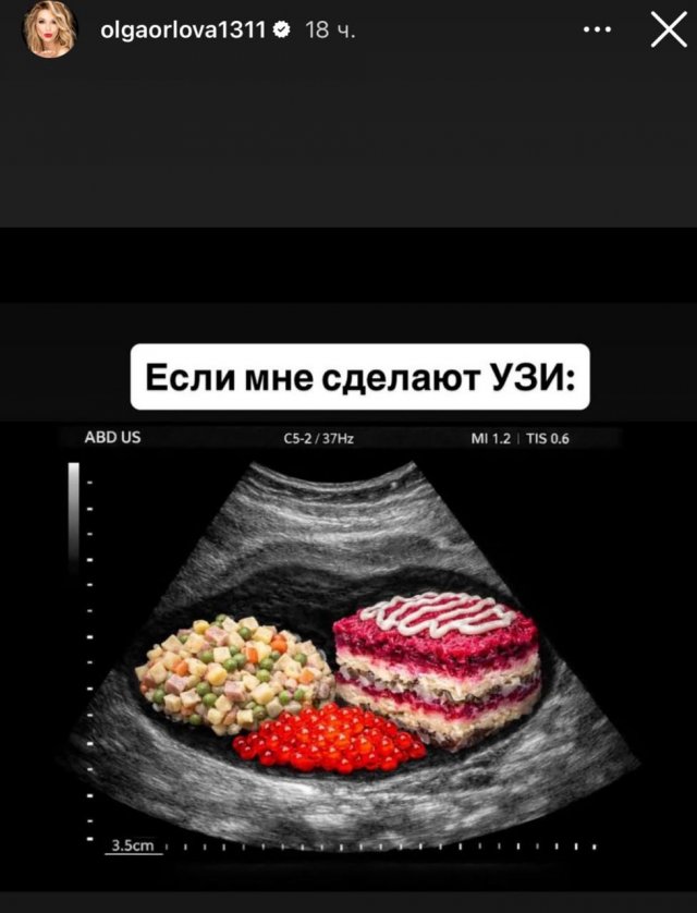 Лучшие шутки и мемы из Сети - 09.01.2026