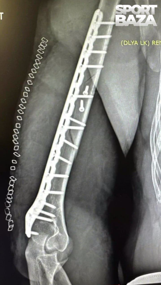 Аккуратней на спортплощадке
