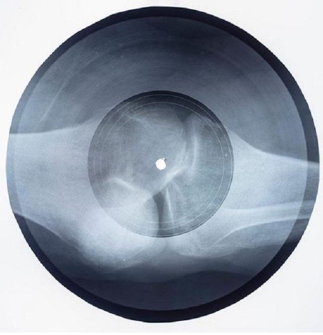 Massive Attack записали кавер легендарной песни Егора Летова "Все идет по плану" на рентгеновском снимке
