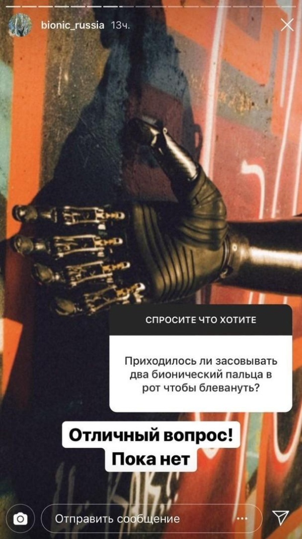 Бионическая рука: вопросы и ответы (6 фото)