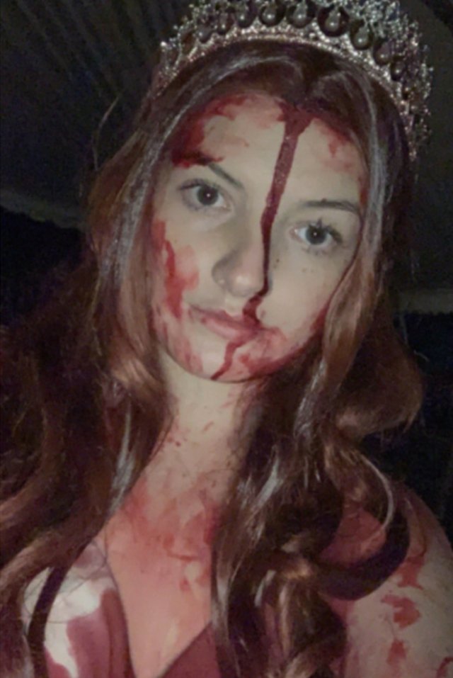 Девушку, попавшую в аварию в Хэллоуин, посчитали мертвой из-за костюма (6 фото)