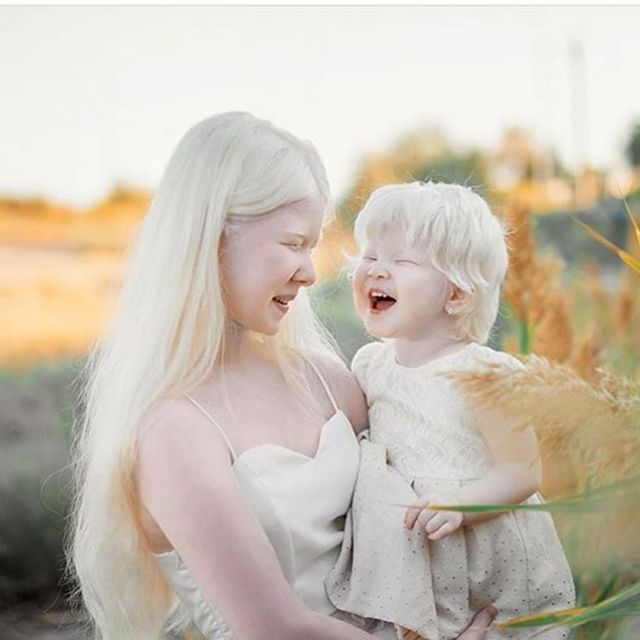 Асель и Камила - сестры-альбиносы из Казахстана, которые покорили модельный мир (10 фото)
