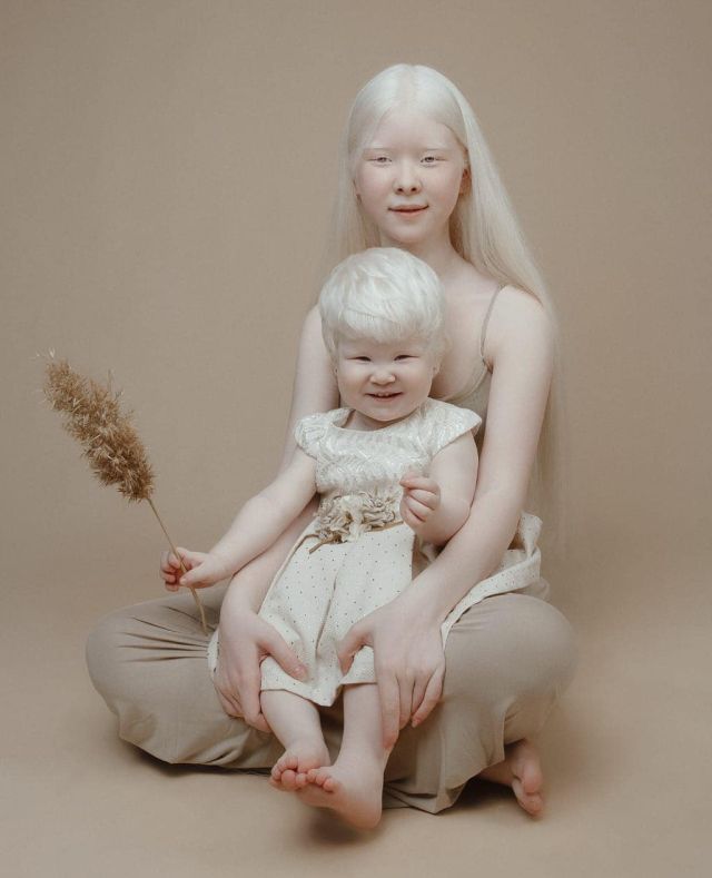 Асель и Камила - сестры-альбиносы из Казахстана, которые покорили модельный мир (10 фото)