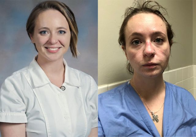 Медсестра Кэтрин Айви до и после работы в больнице