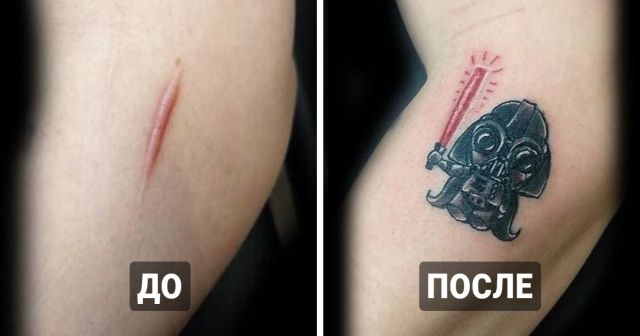 Креативные татуировки, которые помогли людям приобрести уверенность и скрыть недостатки