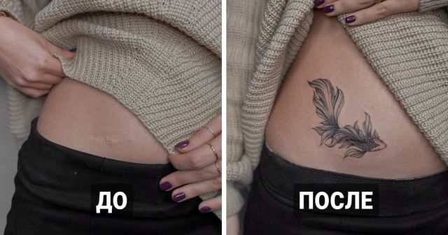 Люди, которые решили не прятать свои шрамы, а обыграть их с помощью татуировок